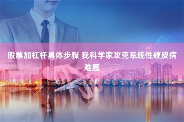 股票加杠杆具体步骤 我科学家攻克系统性硬皮病难题